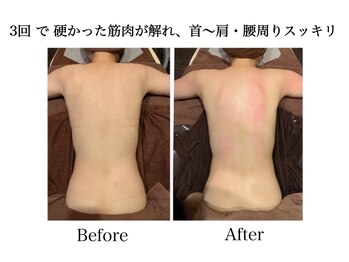 ナチュラーレ 天王寺店(Naturale)/痩身リンパマッサージ二の腕美脚