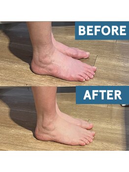 ザ コンディショニングルーム コガオスタジオ 自由が丘店(KOGAOSTUDIO)/ビフォーアフター　むくみ