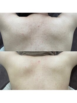 ウルル(ULuLu)/ボディーカーボキシー!