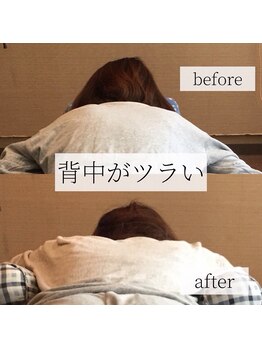 ミーツ(MEETS)/肩こり頭痛/吐き気/猫背 1回