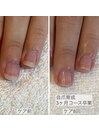 爪の形がコンプレックス