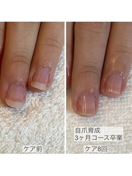 ココモ(cocomo)/爪の形がコンプレックス