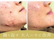 ムギ サロン(mugi salon)