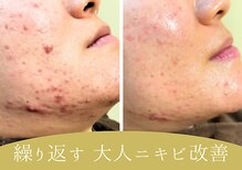 ムギ サロン(mugi salon)
