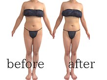 ウィッシュ(WISH)/40代女性セルライトゼロ痩身