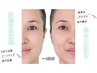 【敏感肌&肌質改善】毛穴洗浄＋CE美容液導入＋バリア機能UP&保湿パック60分