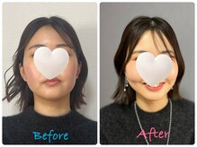 キラリナ/20代☆トータル診断