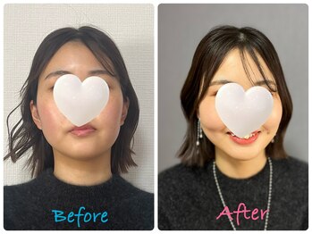 キラリナ/20代☆トータル診断