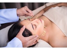 ほぐせる スター鍼灸接骨整体院 竹ノ塚 竹ノ塚東口駅前店/美容鍼！