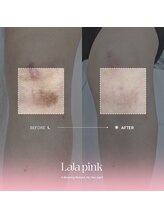 カルム(Calme)/Lalapink