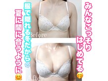 美人バスト 掛川店の雰囲気（バストアップの概念が変わるプロモ医師も通うオーダーメイド施術）