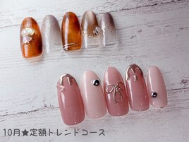 定額トレンド