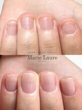 マリーロール 淀屋橋本店(Marie Laure)/自爪育成/深爪矯正/ネイルケア