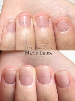 マリーロール 淀屋橋本店(Marie Laure)/自爪育成/深爪矯正/ネイルケア