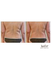 サプナジー(Suppnrgy)/カスタムトリートメント