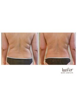 サプナジー(Suppnrgy)/カスタムトリートメント