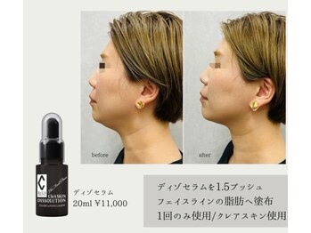 マリス(MARISS)/【小顔/ハーブピーリング/毛穴】