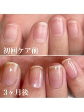 ミラ(Mila)/ジェルネイルをお休みされる方も