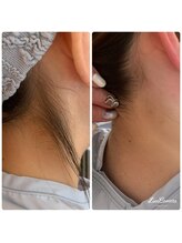 ファーノ/うなじ美人。天然Wax脱毛