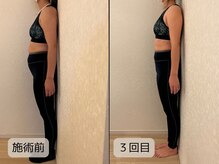 優子さんの美容矯正サロンの雰囲気（ぽっこりお腹スッキリ！オールハンドの痩身技術（池袋ブライダル）