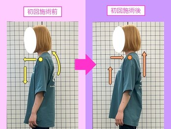 八女整体院/~巻き肩・猫背~
