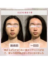 エレーニ 麻布十番(ELENI)/頭蓋骨小顔コルギ/港区/麻布十番