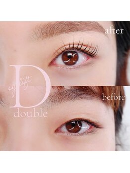 マドモア 飾磨店(MADEMORE)/【ダブルアイリフト】ＡＦＴＥＲ