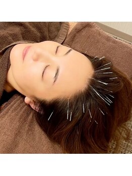 友愛はりきゅう美容整体院/育毛促進鍼