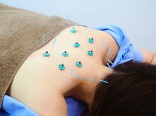 ウル鍼灸整骨院/鍼灸