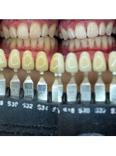 トウキョウスワーズ 池袋店(TOKYO SWRS)/#ホワイトニング #池袋 #渋谷