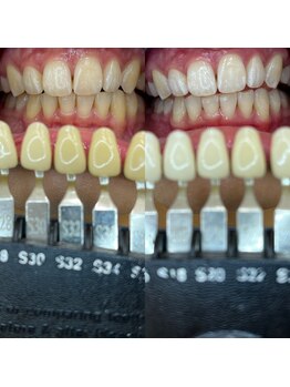 トウキョウスワーズ 池袋店(TOKYO SWRS)/#ホワイトニング #池袋 #渋谷