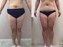 ビラ 銀座店(BILA)/キャビラジ