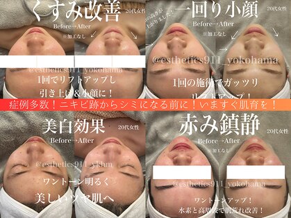 エステティックス ナインワンワン 横浜(Esthetics911) の写真