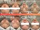 エステティックス ナインワンワン 横浜(Esthetics911) の写真