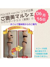 まごんて整体院/肩こり/首/不眠/肩甲骨/背中/腰