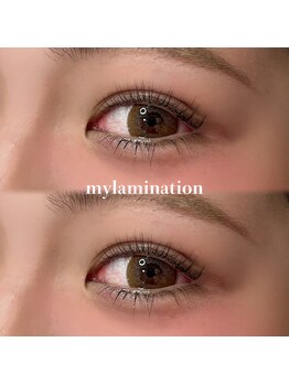 トラスト(Trust)/上下パーマで中顔面短縮!