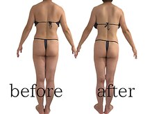 ウィッシュ(WISH)/40代女性セルライトゼロ痩身