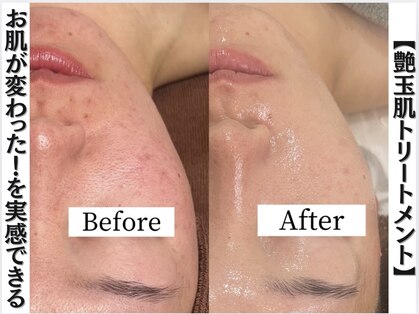 フローレンス(Florence)の写真