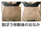 ブレスト 新宿本店(Breast)の写真
