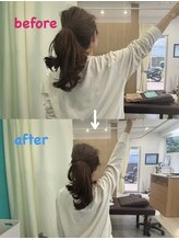 西宮ヤノ整骨院/挙げることが辛い、肩の痛み