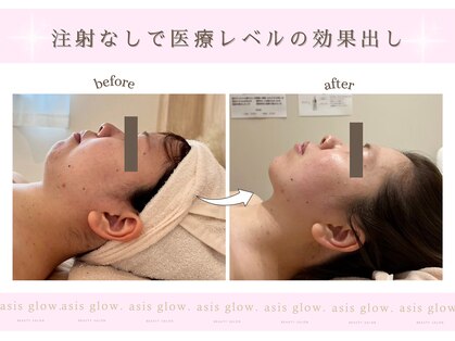 エイシスグロウ(asis glow.)の写真