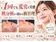 ミライ(Mirai)の写真
