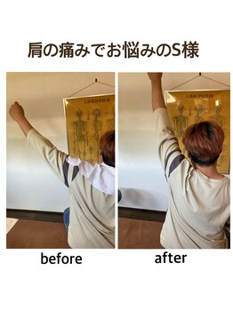 芦田整体療術院/徳島から来院したS様
