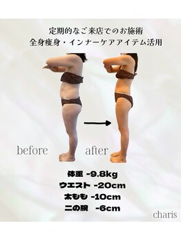 カリス(charis)/ビフォーアフター
