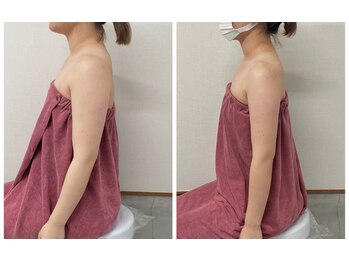 ブリランテ(Brillante)/5ヶ月と11/13