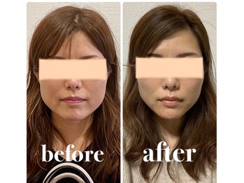 クリーム 京都店(Cream)/エラは美人顔の鍵を握っている!