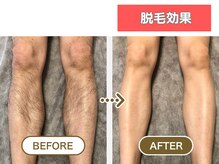 HGB 東山公園駅前店/男性｜30代｜会社員