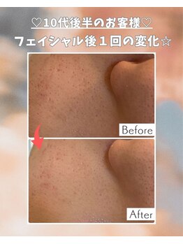 エステサロン 凛/オールハンドエステの力