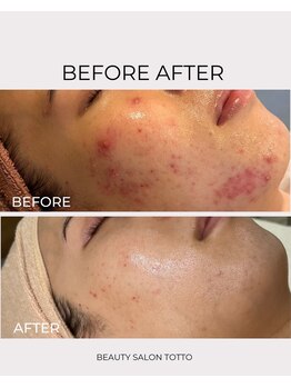 トット 恵比寿(totto)/ケア症例