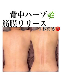 サロンツキ(salon tuki)/背中ハーブピーリング/症例